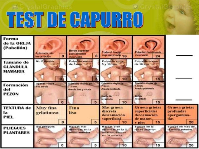 Capurro