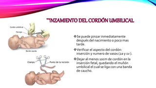 Se puede pinzar inmediatamente
después del nacimiento o poco mas
tarde.
Verificar el aspecto del cordón:
inserción y numero de vasos (2a y 1v ).
Dejar al menos 10cm de cordón en la
inserción fetal, quedando el muñón
umbilical el cual se liga con una banda
de caucho.
 