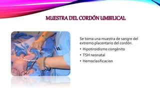 Se toma una muestra de sangre del
extremo placentario del cordón.
• Hipotiroidismo congénito
• TSH neonatal
• Hemoclasificacion
 