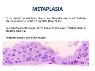 METAPLASIA
Es un cambio reversible en el que una célula diferenciada (Epitelial o
mesenquimal) se sustituye por otro tipo celular.
Sustitución adaptativa por otros tipos celulares que resisten mejor el
entorno adverso.
Reprogramación de células madre.
 