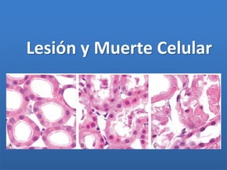 Lesión y Muerte Celular
 
