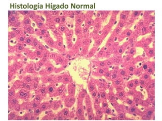 Histología Hígado Normal
 