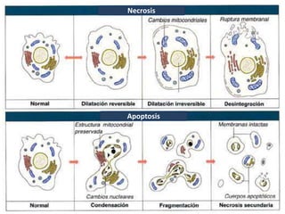 Necrosis
Apoptosis
 
