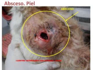 Absceso. Piel
 
