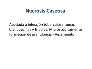 Necrosis Caseosa
Asociada a infección tuberculosa, zonas
blanquecinas y friables. Microscópicamente
formación de granulomas - Aislamiento
 