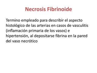 Necrosis Fibrinoide
Termino empleado para describir el aspecto
histológico de las arterias en casos de vasculitis
(inflamación primaria de los vasos) e
hipertensión, al depositarse fibrina en la pared
del vaso necrótico
 