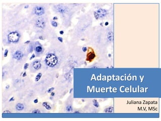Adaptación y
Muerte Celular
Juliana Zapata
M.V, MSc
 