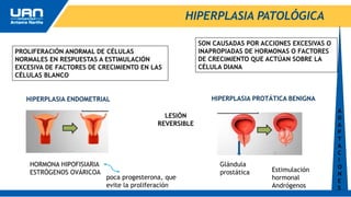 HIPERPLASIA PATOLÓGICA
SON CAUSADAS POR ACCIONES EXCESIVAS O
INAPROPIADAS DE HORMONAS O FACTORES
DE CRECIMIENTO QUE ACTÚAN SOBRE LA
CÉLULA DIANA
PROLIFERACIÓN ANORMAL DE CÉLULAS
NORMALES EN RESPUESTAS A ESTIMULACIÓN
EXCESIVA DE FACTORES DE CRECIMIENTO EN LAS
CÉLULAS BLANCO
HIPERPLASIA ENDOMETRIAL HIPERPLASIA PROTÁTICA BENIGNA
HORMONA HIPOFISIARIA
ESTRÓGENOS OVÁRICOA
poca progesterona, que
evite la proliferación
Glándula
prostática Estimulación
hormonal
Andrógenos
A
D
A
P
T
A
C
I
O
N
E
S
LESIÓN
REVERSIBLE
 