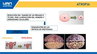 ATROFIA
REDUCCIÓN DEL TAMAÑO DE UN ÓRGANO O
TEJIDO, POR LA REDUCCIÓN DEL NÚMERO Y
DIMENSIONES CELULARES
DISMUNUCIÓN DE LAS
SÍNTESIS DE PROTEÍANAS
ATROFÍA
FISIOLÓGICA PATOLÓGICA
 