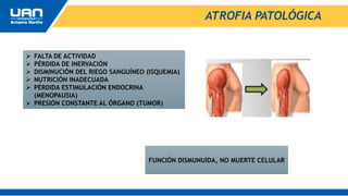 ATROFIA PATOLÓGICA
 FALTA DE ACTIVIDAD
 PÉRDIDA DE INERVACIÓN
 DISMINUCIÓN DEL RIEGO SANGUÍNEO (ISQUEMIA)
 NUTRICIÓN INADECUADA
 PÉRDIDA ESTIMULACIÓN ENDOCRINA
(MENOPAUSIA)
 PRESIÓN CONSTANTE AL ÓRGANO (TUMOR)
FUNCIÓN DISMUNUÍDA, NO MUERTE CELULAR
 