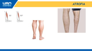 ATROFIA
 