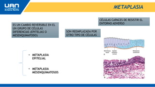 METAPLASIA
ES UN CAMBIO REVERSIBLE EN EL
UN GRUPO DE CÉLULAS
DIFERENCIAS (EPITELIAS O
MESENQUIMATODO)
SON REEMPLAZADA POR
OTRO TIPO DE CÉLULAS
CÉLULAS CAPACES DE RESISTIR EL
ENTORNO ADVERSO
• METAPLASIA
EPITELIAL
• METAPLASIA
MESENQUIMATOSOS
 