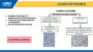 LESIÓN REVERSIBLE
 CAMBIOS FUNCIONALES Y
MORFOLÓGICOS SON REVERSIBLES
 LESIÓN NO SUELTENER DAÑO DE
LA MENBRANA.
 NO HAY DISOLICIÓN NUCLEAR
SI SE RETIRA EL ESTÍMULO
 