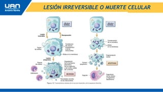 LESIÓN IRREVERSIBLE O MUERTE CELULAR
 