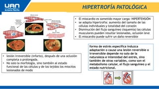 HIPERTROFÍA PATOLÓGICA
• El miocardio es sometido mayor carga: HIPERTENSIÓN
• se adapta hipertrofia: aumento del tamaño de las
células individuales y totalidad del corazón
• Disminución del flujo sanguíneo (isquemia) las células
musculares pueden resultar lesionadas, oclusión leve
• El miocardio puede sufrir un daño reversible
• lesión irreversible (infarto), después de una oclusión
completa o prolongada.
• No solo la morfología, sino también al estado
funcional de las células y de los tejidos los miocitos
lesionados de modo
forma de estrés específica induzca
adaptación o cause una lesión reversible o
irreversible depende no solo de la
naturaleza e intensidad del estrés, sino
también de otras variables, como son el
metabolismo celular, el flujo sanguíneo y el
estado nutricional.
 
