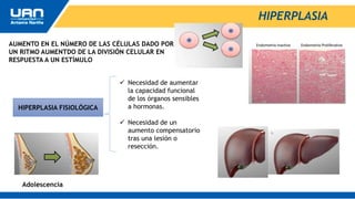 HIPERPLASIA
AUMENTO EN EL NÚMERO DE LAS CÉLULAS DADO POR
UN RITMO AUMENTDO DE LA DIVISIÓN CELULAR EN
RESPUESTA A UN ESTÍMULO
HIPERPLASIA FISIOLÓGICA
 Necesidad de aumentar
la capacidad funcional
de los órganos sensibles
a hormonas.
 Necesidad de un
aumento compensatorio
tras una lesión o
resección.
Adolescencia
 