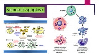 Necrose x Apoptose
 