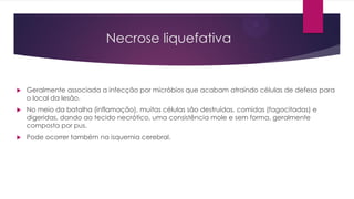 Necrose liquefativa
 Geralmente associada a infecção por micróbios que acabam atraindo células de defesa para
o local da lesão.
 No meio da batalha (inflamação), muitas células são destruídas, comidas (fagocitadas) e
digeridas, dando ao tecido necrótico, uma consistência mole e sem forma, geralmente
composta por pus.
 Pode ocorrer também na isquemia cerebral.
 