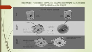 ESQUEMA DOS PROCESSOS DE ADAPTAÇÕES CELULARES E ILUSTRAÇÃO DAS ALTERAÇÕES
MORFOLÓGICAS DA LESÃO CELULAR
Fonte: Kumar et al. (2010, p. 5 e 13)
 