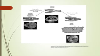 Disponíveis em: <http://massamuscular.blog.br/dicas-para-manter-o-foco-durante-uma-dieta-de-hipertrofia/>.
Acesso em: 30 maio 2015 e Kumar et al. (2010, p. 6).
 