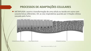 PROCESSOS DE ADAPTAÇÕES CELULARES
 METAPLASIA: ocorre a transformação de uma célula ou tecido em outro com
características diferentes. EX: as vias respiratórias quando por irritação crônica
causada pelo fumo
Embasamento da membrana Coluna Eptelial Normal Metaplastia escamosa
Fonte: Kumar et al. (2010, p. 5 e 13)
 