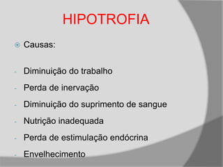  Causas:
- Diminuição do trabalho
- Perda de inervação
- Diminuição do suprimento de sangue
- Nutrição inadequada
- Perda de estimulação endócrina
- Envelhecimento
HIPOTROFIA
 