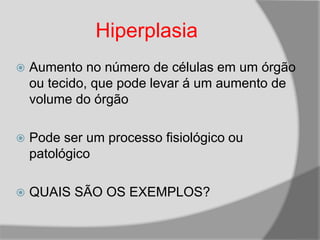Hiperplasia
 Aumento no número de células em um órgão
ou tecido, que pode levar á um aumento de
volume do órgão
 Pode ser um processo fisiológico ou
patológico
 QUAIS SÃO OS EXEMPLOS?
 