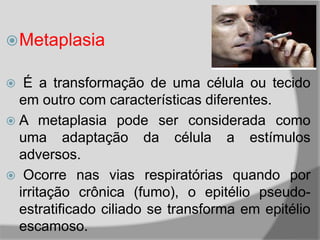 Metaplasia
 É a transformação de uma célula ou tecido
em outro com características diferentes.
 A metaplasia pode ser considerada como
uma adaptação da célula a estímulos
adversos.
 Ocorre nas vias respiratórias quando por
irritação crônica (fumo), o epitélio pseudo-
estratificado ciliado se transforma em epitélio
escamoso.
 