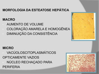 MORFOLOGIA DA ESTEATOSE HEPÁTICA
MACRO
• AUMENTO DE VOLUME
• COLORAÇÃO AMARELA E HOMOGÊNEA
• DIMINUIÇÃO DA CONSISTÊNCIA
MICRO
• VACÚOLOSCITOPLASMÁTICOS
OPTICAMENTE VAZIOS
• NÚCLEO RECHAÇADO PARA
PERIFERIA
 