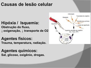 Hipóxia / Isquemia:
Obstrução do fluxo,
↓ oxigenação, ↓ transporte de O2
Agentes físicos:
Trauma, temperatura, radiação.
Agentes químicos:
Sal, glicose, oxigênio, drogas.
Causas de lesão celular
 