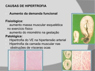 CAUSAS DE HIPERTROFIA
• Aumento da demanda funcional
Fisiológica:
• aumento massa muscular esquelética
no exercício físico
• aumento do miométrio na gestação
Patológica:
• Hipertrofia do VE na hipertensão arterial
• Hipertrofia da camada muscular nas
• obstruções de vísceras ocas
 