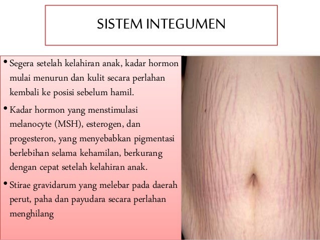 Adaptasi Fisiologis Dan Psikologis Ibu Post Partum