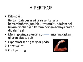 Hipertrofi otot