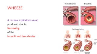 Adapted imnci cough 2020 | PDF