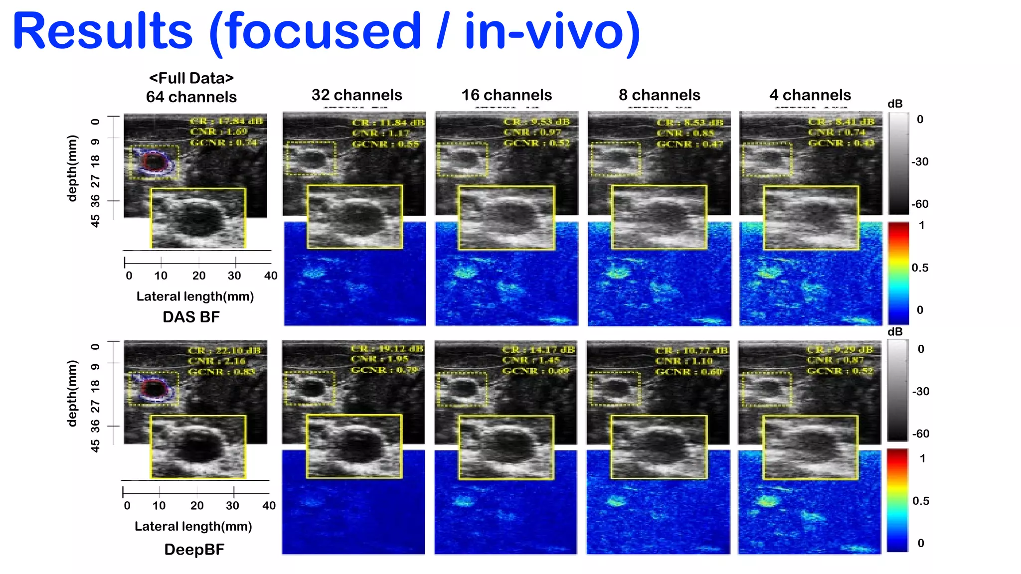 Adaptive and compressive beamforming using deep learning for medical ...