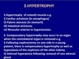 3.Hypertrophy of smooth muscle e.g.
i) Cardiac achalasia (in oesophagus)
ii) Pyloric stenosis (in stomach)
iii) Intestinal strictures
iv) Muscular arteries in hypertension.
4. Compensatory hypertrophy may occur in an organ
when the contralateral organ is removed e.g.
i) Following nephrectomy on one side in a young
patient, there is compensatory hypertrophy as well as
hyperplasia of the nephrons of the other kidney.
ii) Adrenal hyperplasia following removal of one adrenal
gland
3.HYPERTROPHY
 