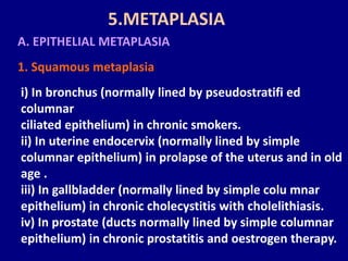 A. EPITHELIAL METAPLASIA
1. Squamous metaplasia
i) In bronchus (normally lined by pseudostratifi ed
columnar
ciliated epithelium) in chronic smokers.
ii) In uterine endocervix (normally lined by simple
columnar epithelium) in prolapse of the uterus and in old
age .
iii) In gallbladder (normally lined by simple colu mnar
epithelium) in chronic cholecystitis with cholelithiasis.
iv) In prostate (ducts normally lined by simple columnar
epithelium) in chronic prostatitis and oestrogen therapy.
5.METAPLASIA
 