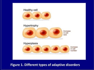 Figure 1. Different types of adaptive disorders
 