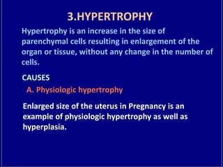 3.HYPERTROPHY
Hypertrophy is an increase in the size of
parenchymal cells resulting in enlargement of the
organ or tissue, without any change in the number of
cells.
CAUSES
A. Physiologic hypertrophy
Enlarged size of the uterus in Pregnancy is an
example of physiologic hypertrophy as well as
hyperplasia.
 