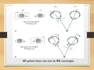 Adaptive mechanism of squint | PPT