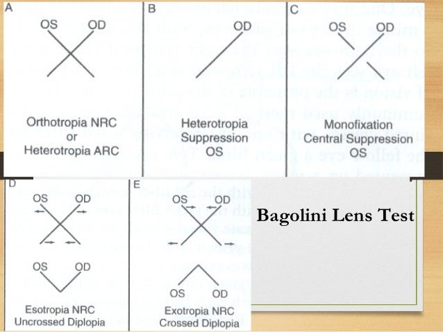 Bagolini Glasses Arc Bagolini Glasses Arc