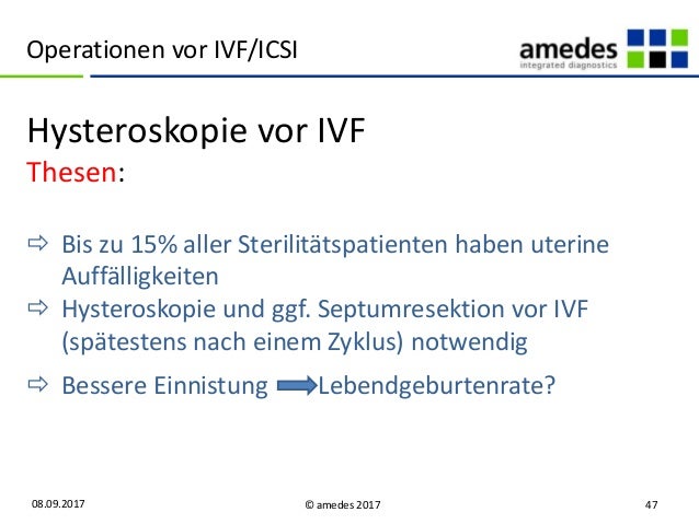 Add Ons Bei Ivf Hokus Pokus Slideshare