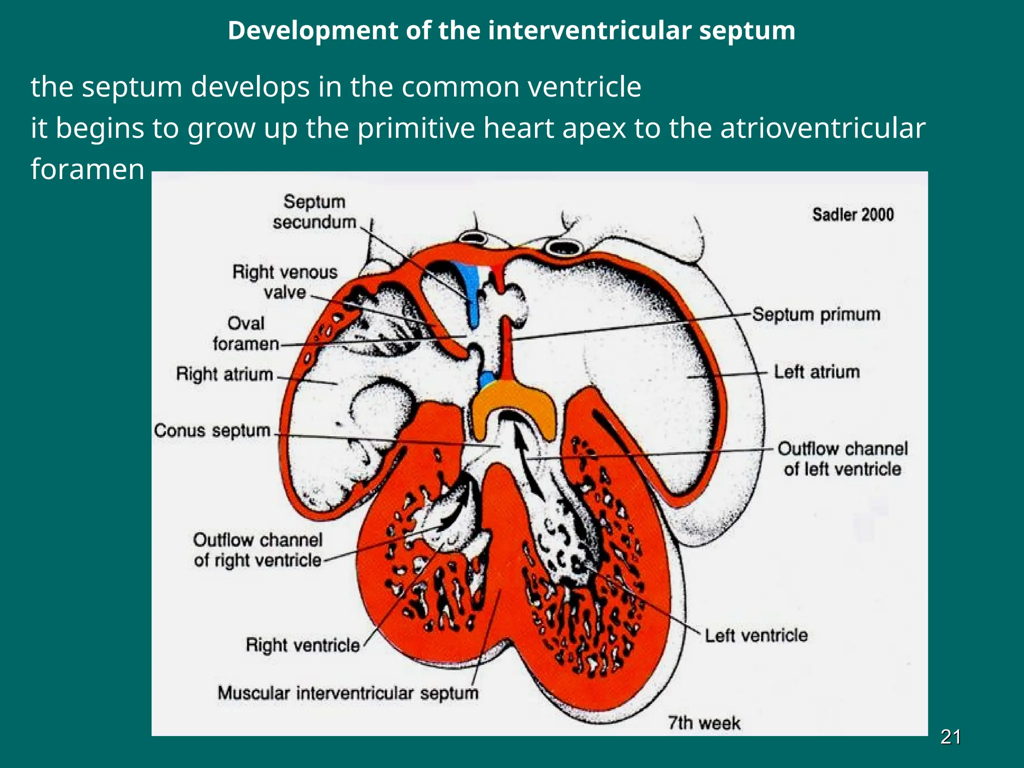 Development of the interventricular septum
the septum develops in the common ventricle
it begins to grow up the primitive heart apex to the atrioventricular
foramen
21
21
 