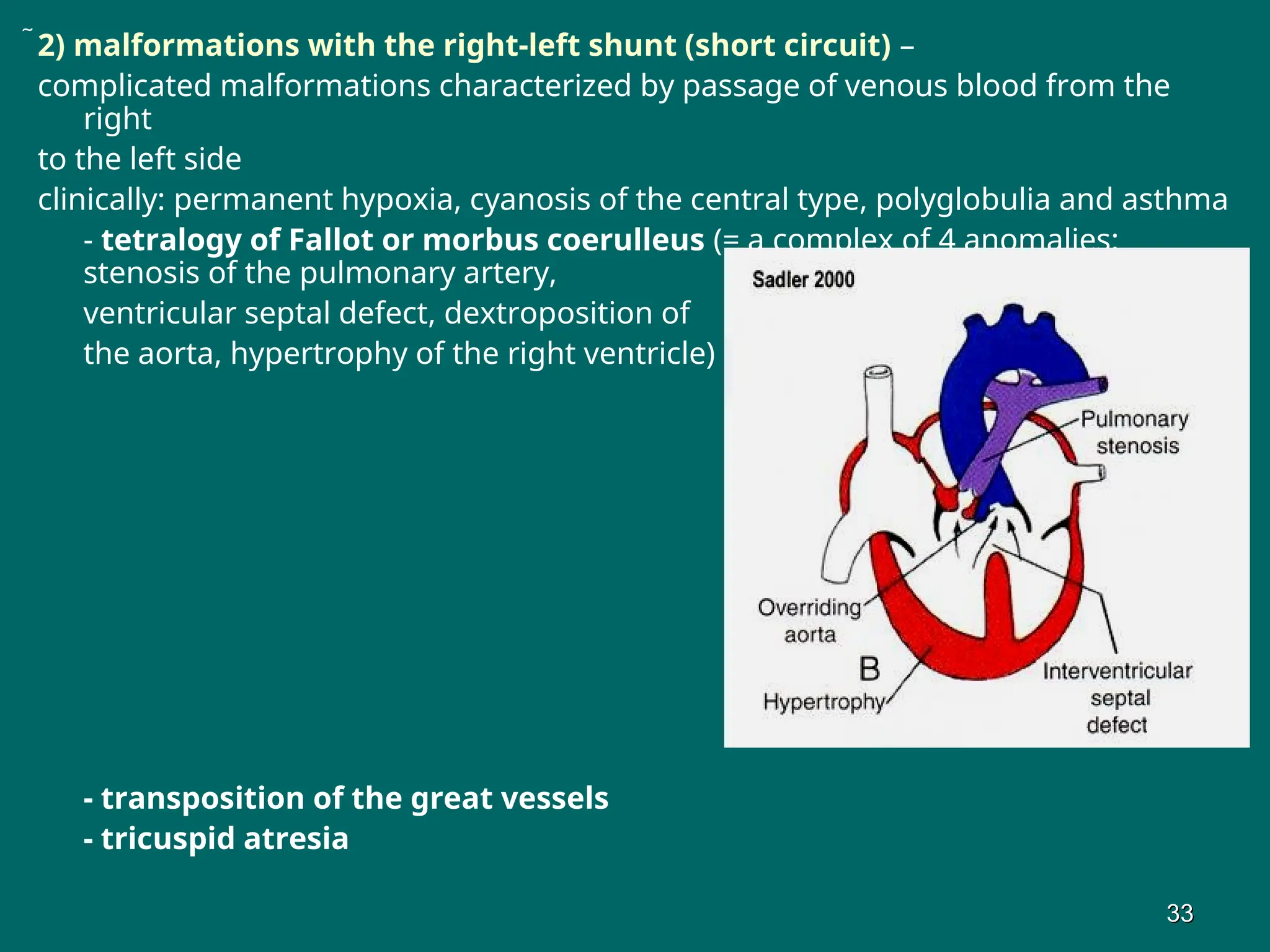 2) malformations with the right-left shunt (short circuit) –
complicated malformations characterized by passage of venous blood from the
right
to the left side
clinically: permanent hypoxia, cyanosis of the central type, polyglobulia and asthma
- tetralogy of Fallot or morbus coerulleus (= a complex of 4 anomalies:
stenosis of the pulmonary artery,
ventricular septal defect, dextroposition of
the aorta, hypertrophy of the right ventricle)
- transposition of the great vessels
- tricuspid atresia
33
33
 