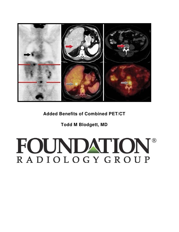 Added benefits of PET/CT Dr. Todd Blodgett