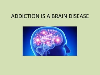 ADDICTION IS A BRAIN DISEASE
 