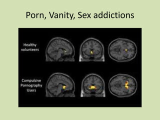 Porn, Vanity, Sex addictions
 