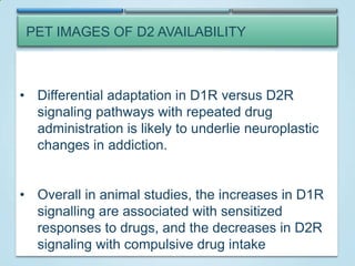 PET IMAGES OF D2 AVAILABILITY

• Differential adaptation in D1R versus D2R
signaling pathways with repeated drug
administration is likely to underlie neuroplastic
changes in addiction.
• Overall in animal studies, the increases in D1R
PET: Cocaine markedly reduces dopamine D2 receptor
signalling are associated with sensitized
availability
The striatum to drugs, and the is largely
healthy
responses of the receptorcontrol (left)while thatred, indicating
decreasescocaine
in D2R
the highest level of
availability,
of the
signaling with compulsive drug intake
abuser has little red.

 