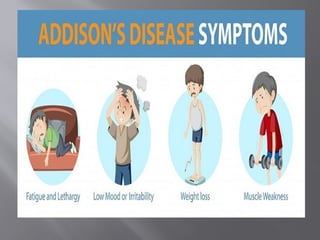 ADDISION DISEASE 2ND YEAR medical surgical nursing.pptx