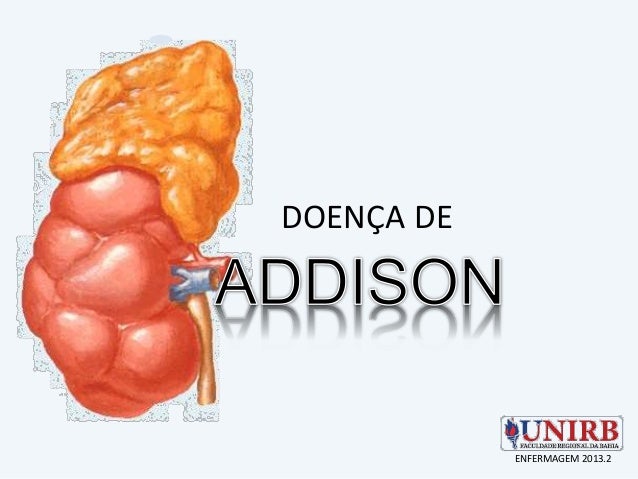 Enfermeira De Addison